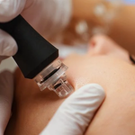 Hydrodermabrasion
