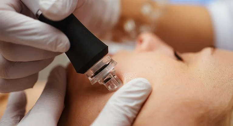 Hydrodermabrasion