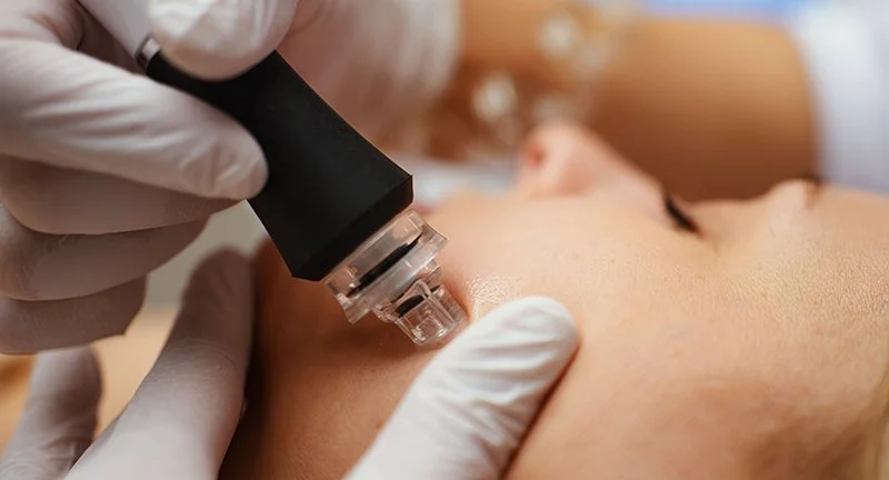 Hydrodermabrasion